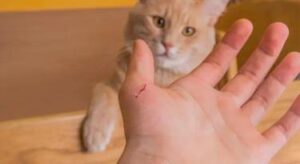 Cat Scratch Disease